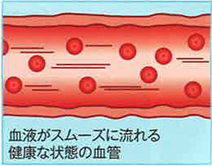 血液サラサラで生活習慣病を防ぐ